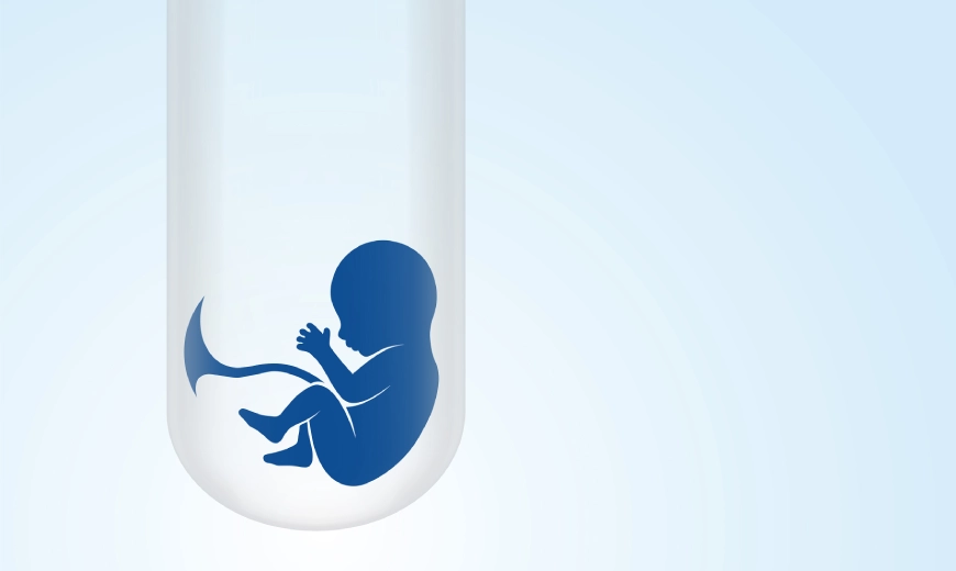 Test Tube Baby Treatment Process and Cost: What You Need to Know