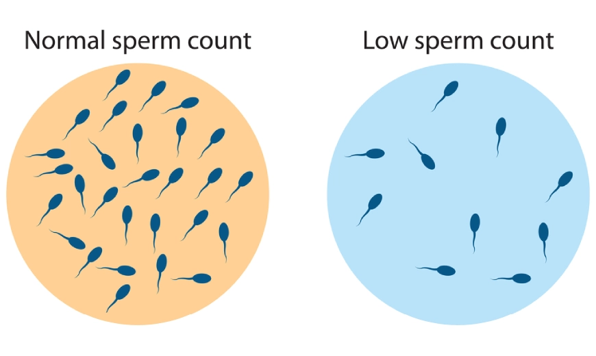 low sperm count