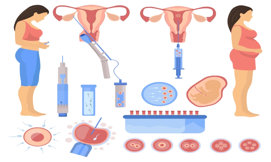 IUI Treatment Myths